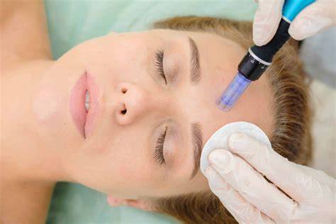 Client undergoing a laser hair removal in a beauty salon